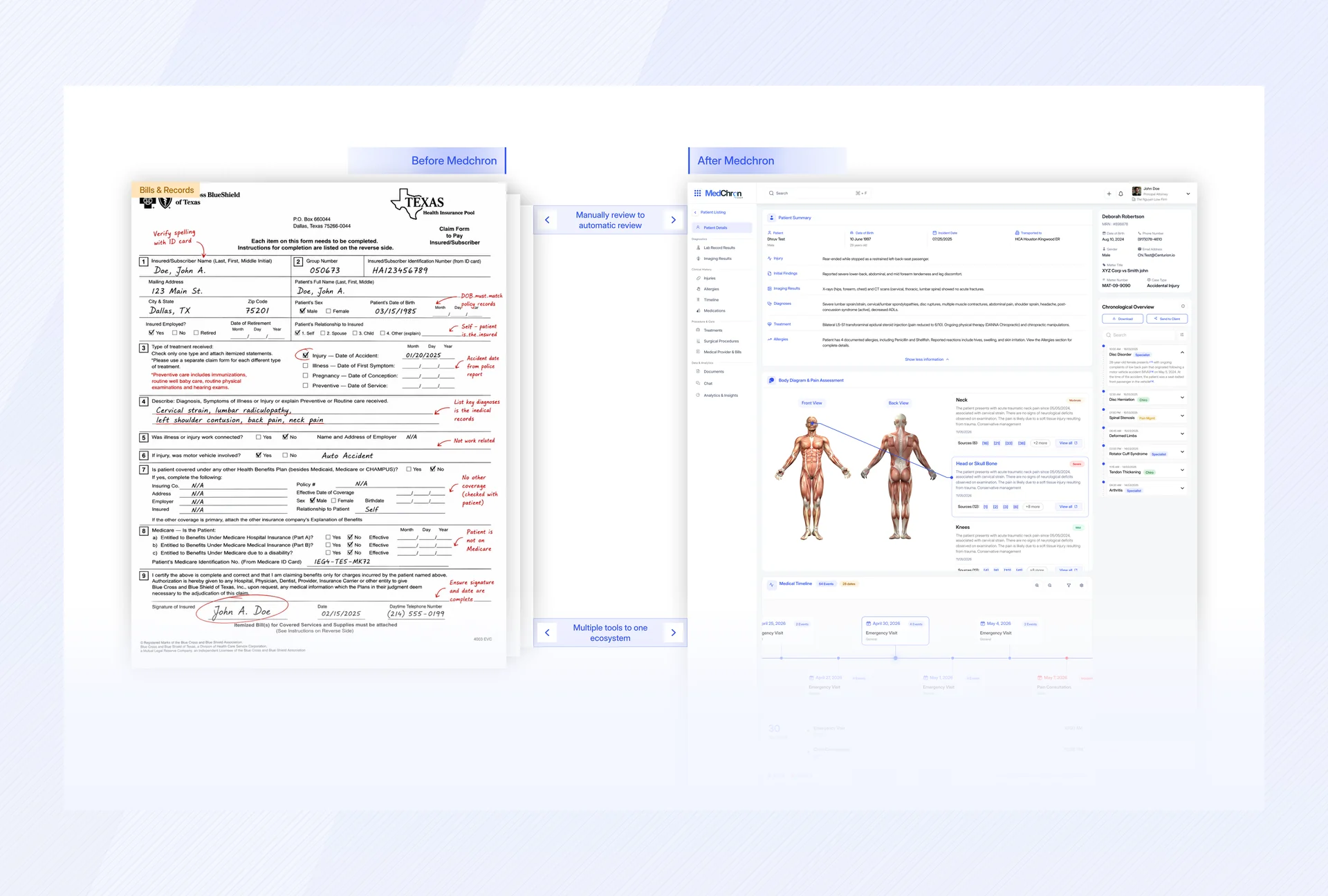 MedChron: Turning Complex Medical Records into Structured Legal Timelines